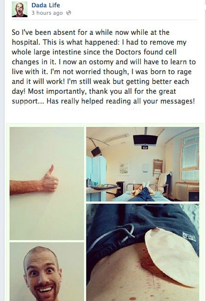 Stefan of Dada Life lets us know that his latest adventure involved removing his large intestine. 